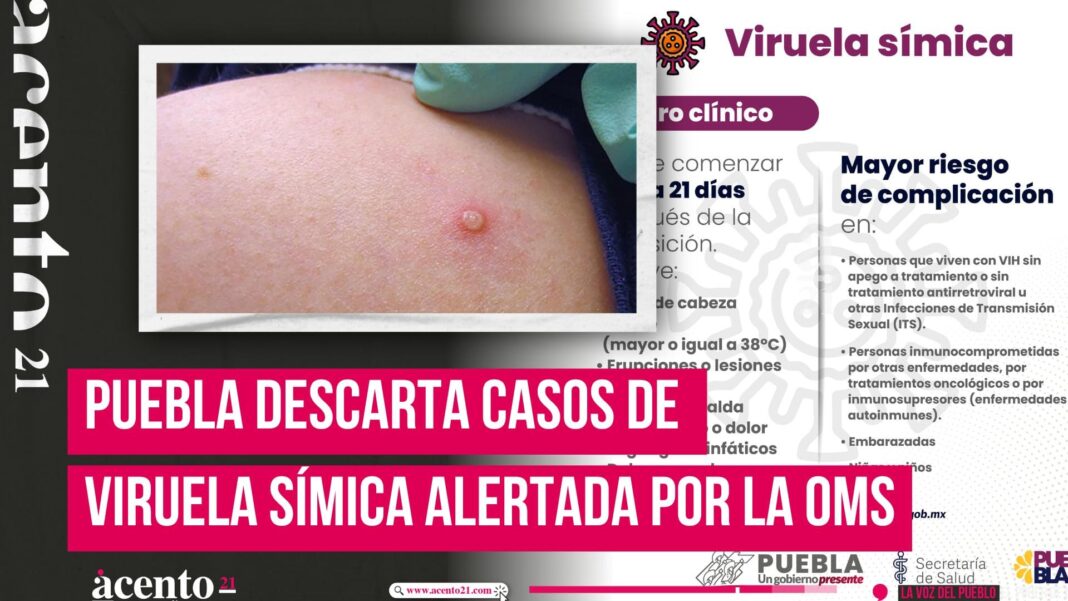 viruela símica alertada por la OMS