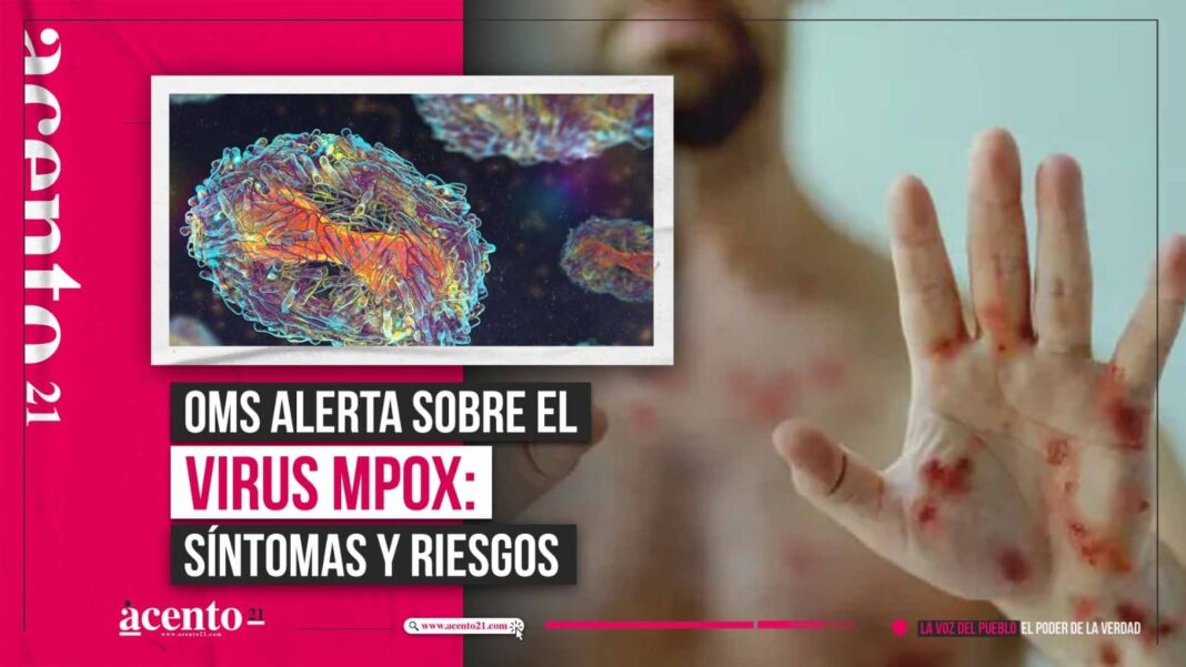 ¿Qué es el Mpox? La OMS alerta sobre este virus y sus síntomas