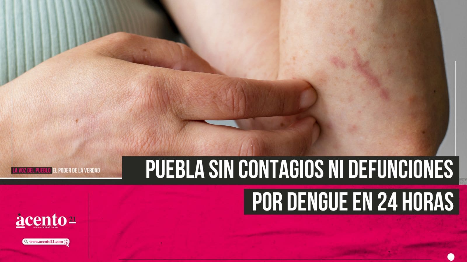 Puebla sin nuevos casos ni defunciones por dengue en 24 horas