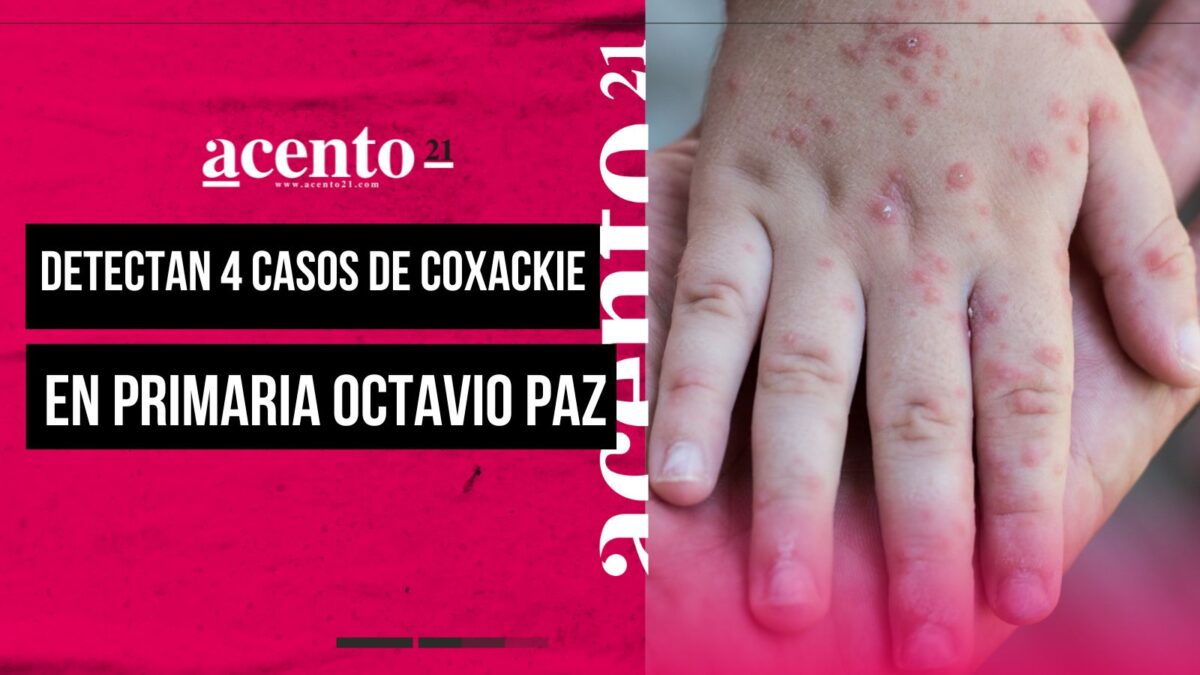 Virus Coxsackie en Puebla: detectan cuatro casos en primaria Octavio Paz