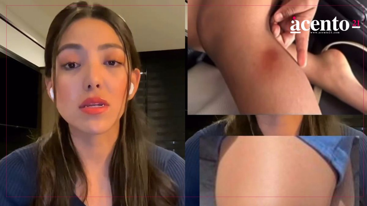 September Vélez exhibe presunta agresión del doctor golpeador contra su hijo