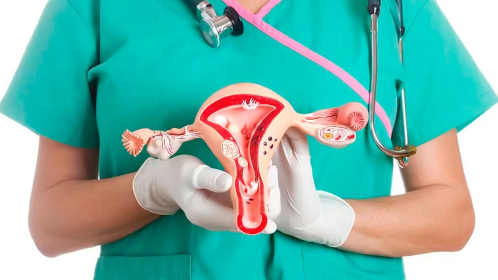 Día de la Lucha contra el Cáncer Cervicouterino: un llamado a la prevención