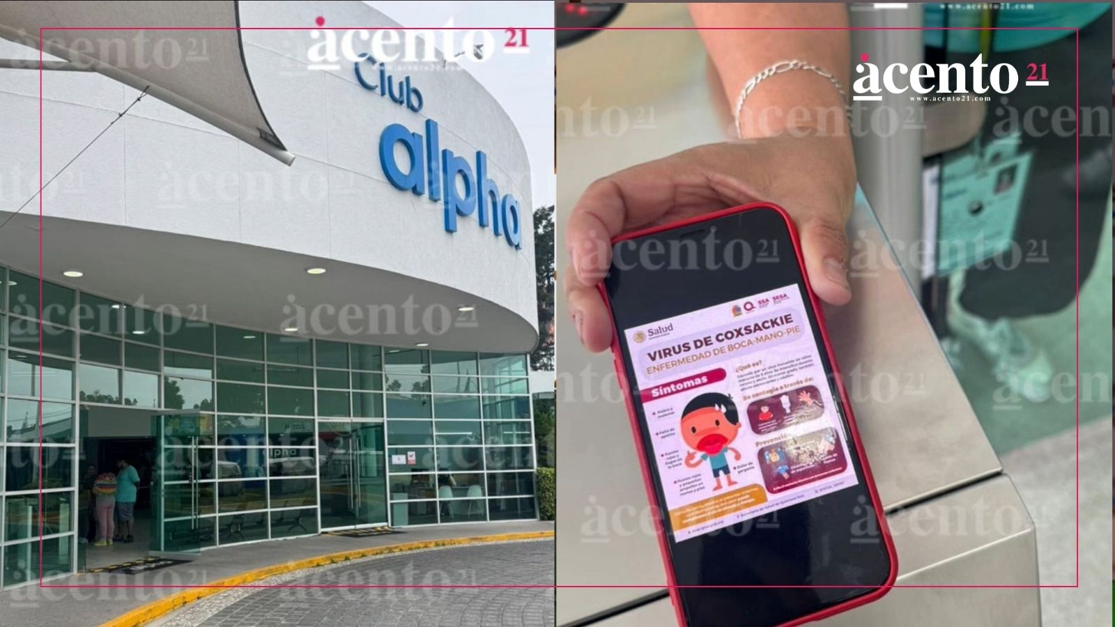 Brote de virus en el Alpha 3: reportan 11 contagios de Coxsackie en curso de verano